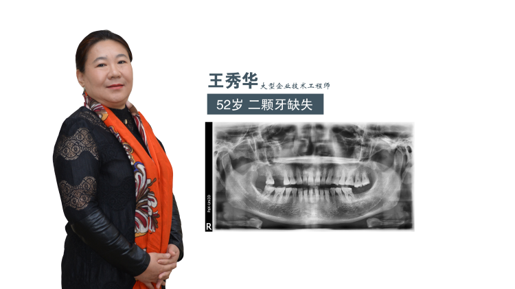 廊坊電視臺(tái)第三季種植牙直播即將上演?。?！