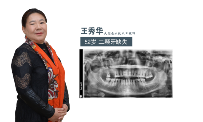廊坊廣播電視臺(tái)全程報(bào)道即刻種植牙直播