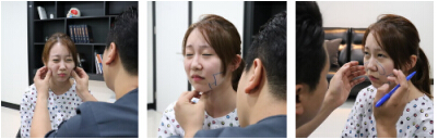 【韓國(guó)輪廓整形實(shí)錄】徐范信幫忙從O臉到V臉，并不需磨骨！
