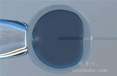 美國試管嬰兒醫(yī)院哪家好？選對(duì)醫(yī)院成功率翻倍