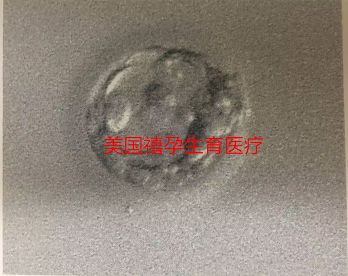 分享點美國試管嬰兒小知識，大齡女性 赴美試管前應(yīng)這么做