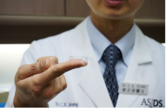 銅錢癬怎么得的？這些內(nèi)容知道得越早越好