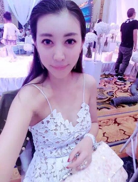 我變美終極秘訣——王明利CGF脂肪移植