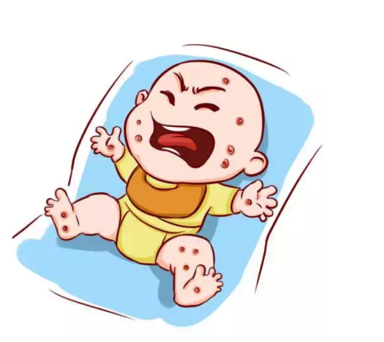 嬰兒奶癬怎么治療？這些方法一看就會(huì)