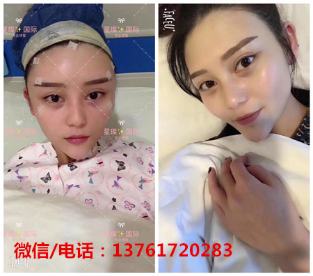 星璨國(guó)際整容招代理嗎？聯(lián)系方式是多少？