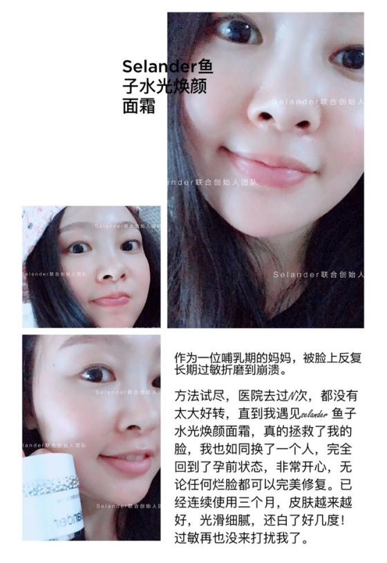 護(hù)膚品中的Selander魚(yú)子面霜 功效到底如何