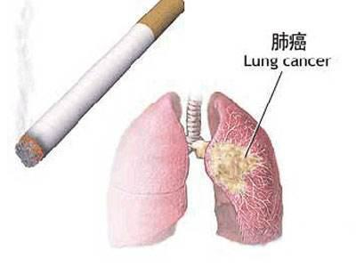 肺癌幫：為什么有人吸煙不得肺癌，這些習(xí)慣要注意