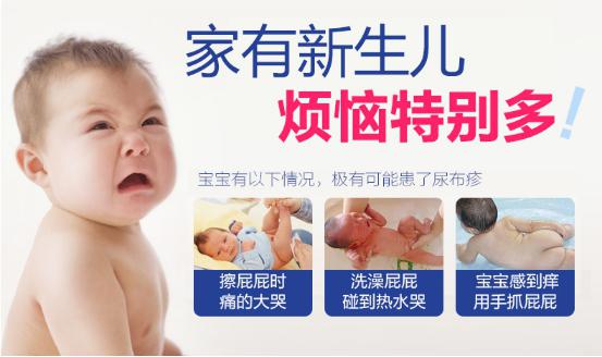 Bepanthen拜耳嬰兒護(hù)臀膏 萬用抗菌 家庭必備