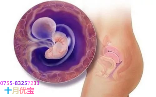 云圖片