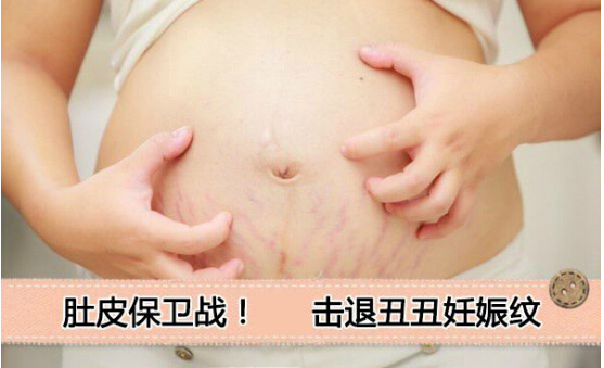 如何去除妊娠紋 這個(gè)去妊娠紋方法不可錯(cuò)過(guò)